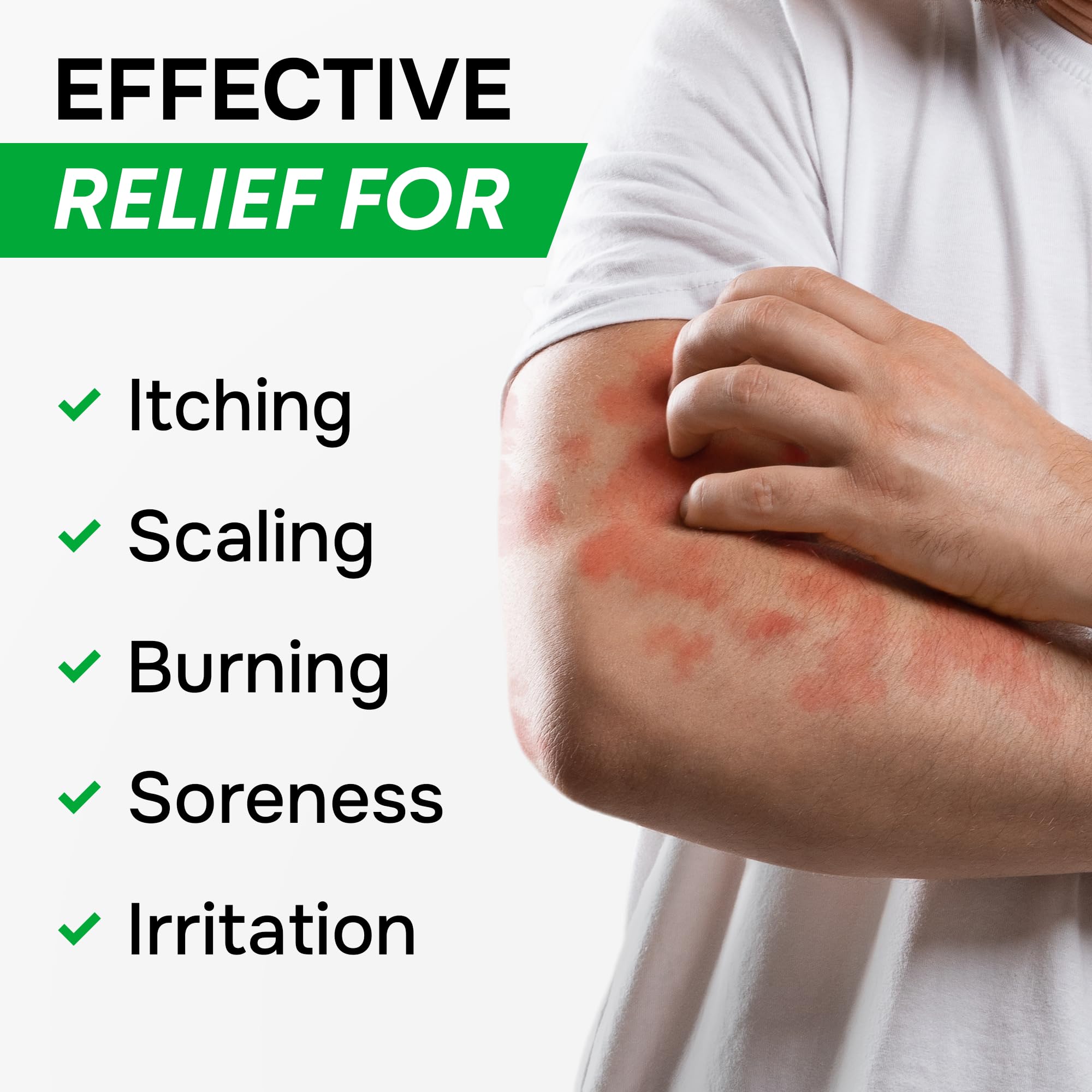 SimplyVital jock itch cream application for soothing itching.