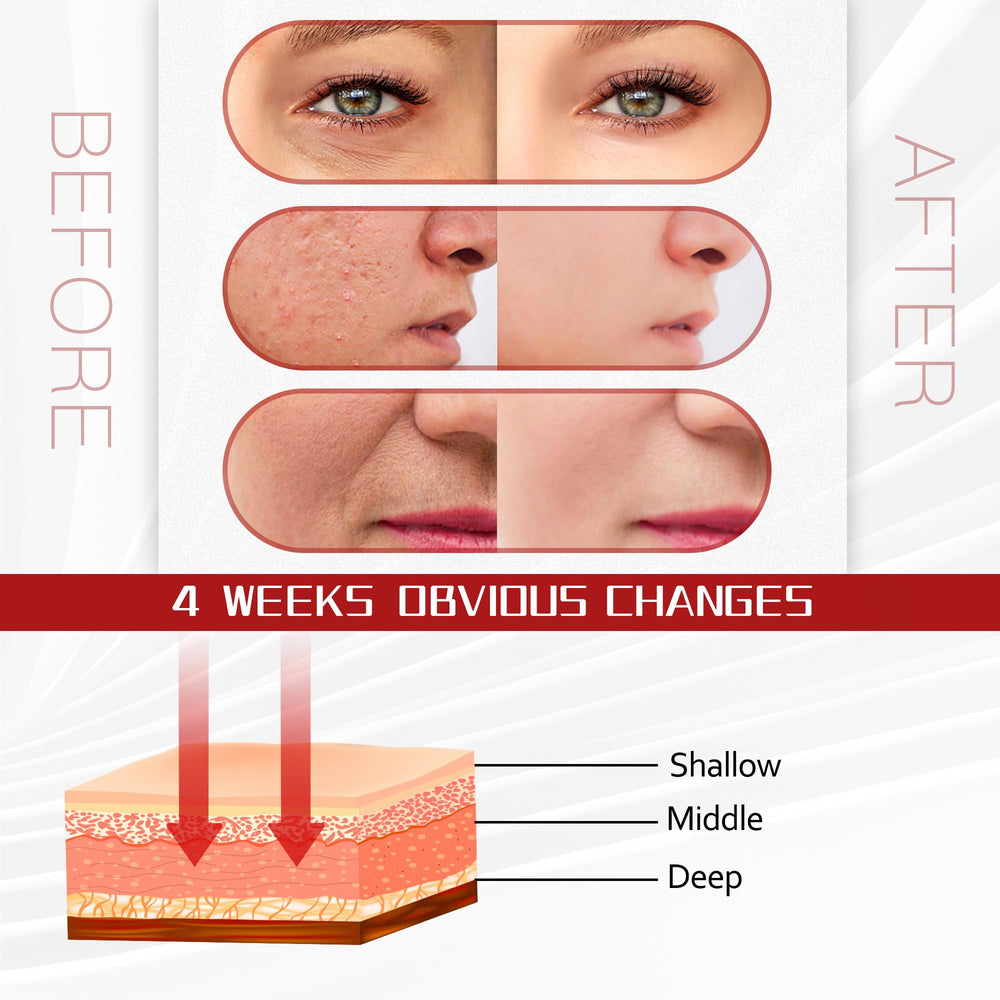 SJFEHLLD seven-color LED face mask offers versatile options for smooth-looking skin.