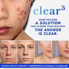 SMNutrition Clear Skin probiotics graphic communicates gut-skin support synergy.
