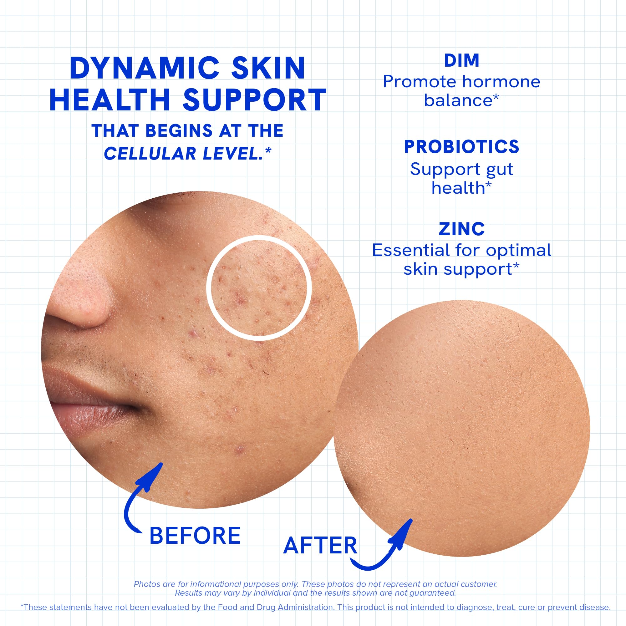 SMNutrition zinc and hyaluronic acid ingredients image emphasizes hydration and resilience.
