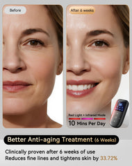 Sobetuar red and infrared wavelengths penetrate deeper for at-home sessions.