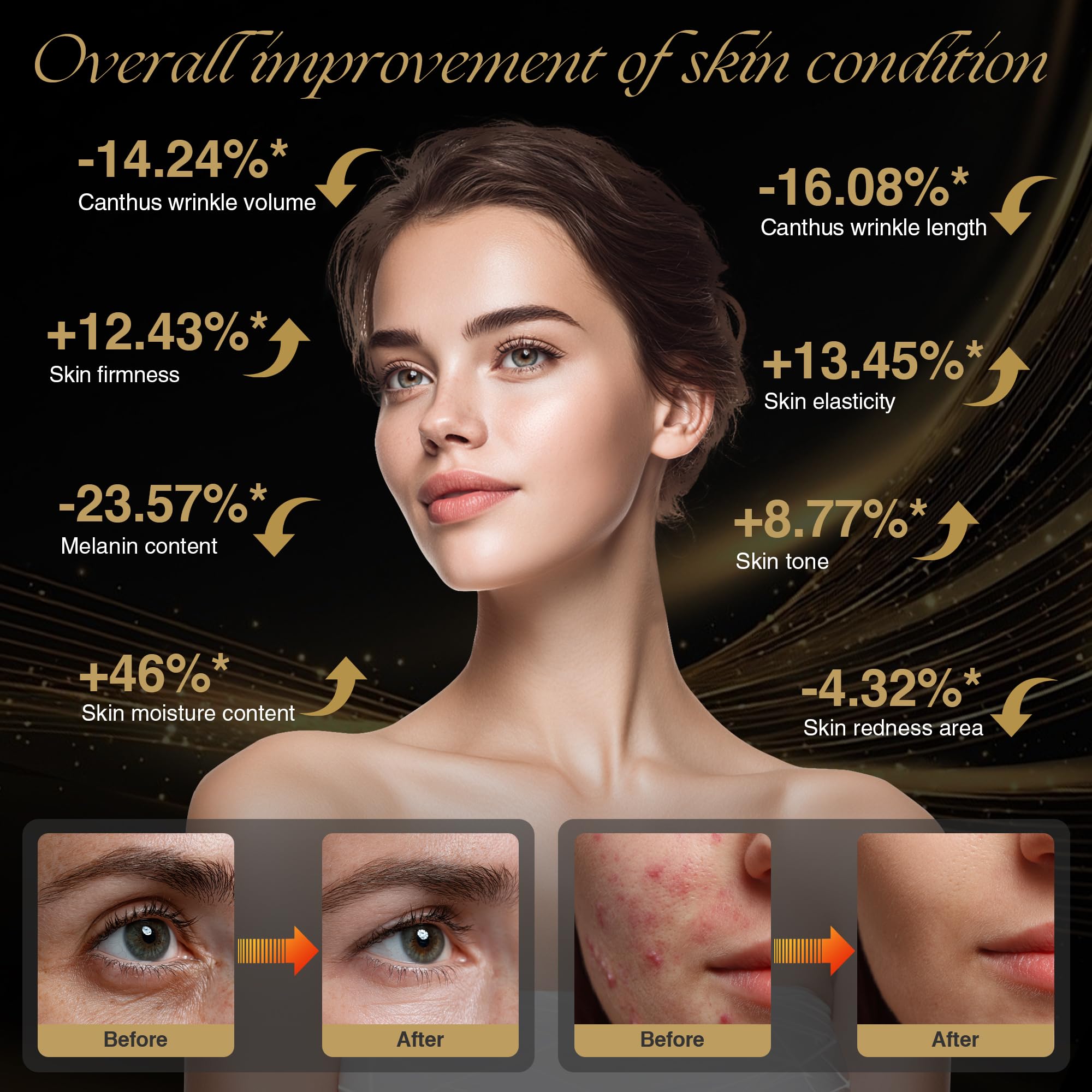 SUPDESIR 4D curved facial fit silicone shell ensures comfortable coverage