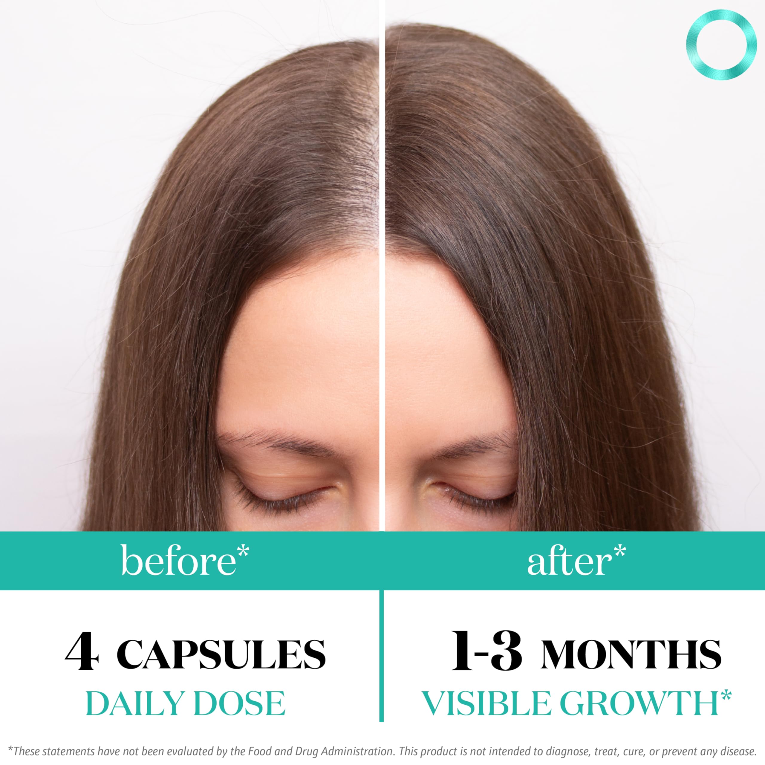 Close-up of Superfood MD Women's Balance capsules for daily hair nourishment