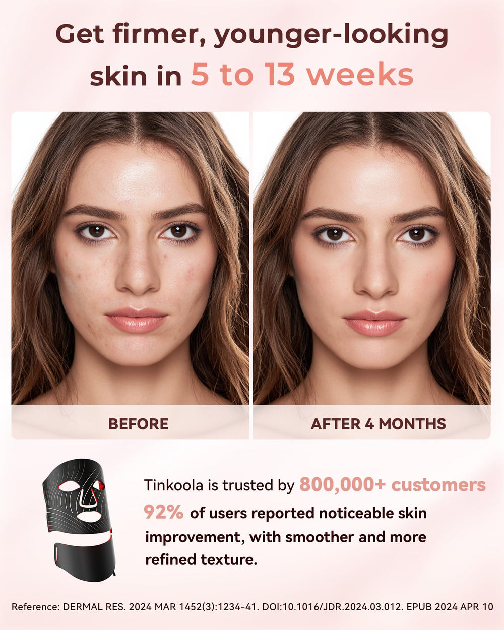 Tinkoola silicone mask offers lightweight comfort during sessions