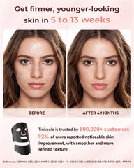 Tinkoola silicone mask offers lightweight comfort during sessions