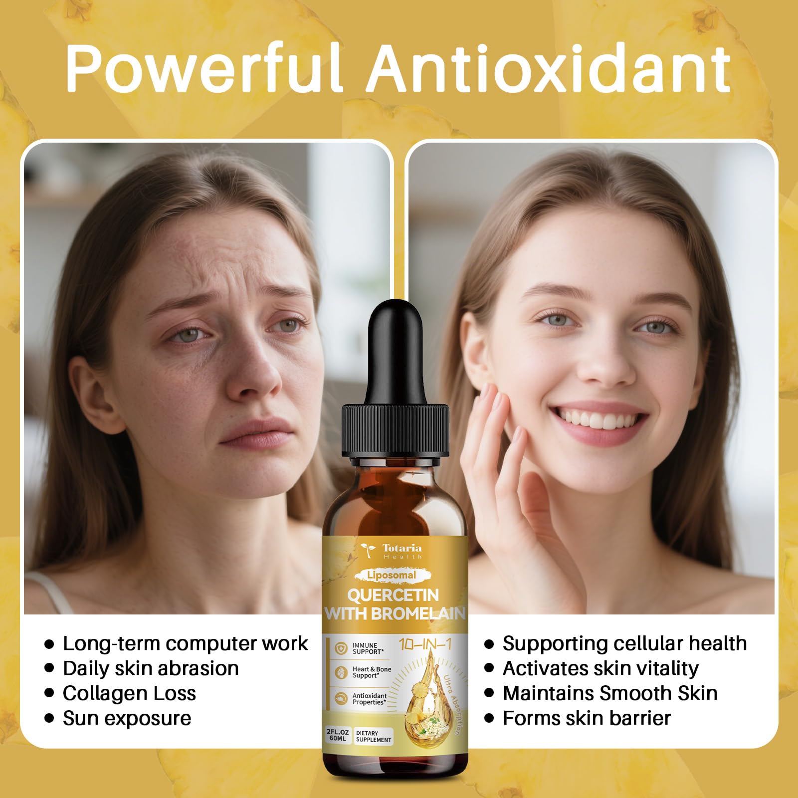 Totaria elderberry, vitamin C, and zinc blend for immune support