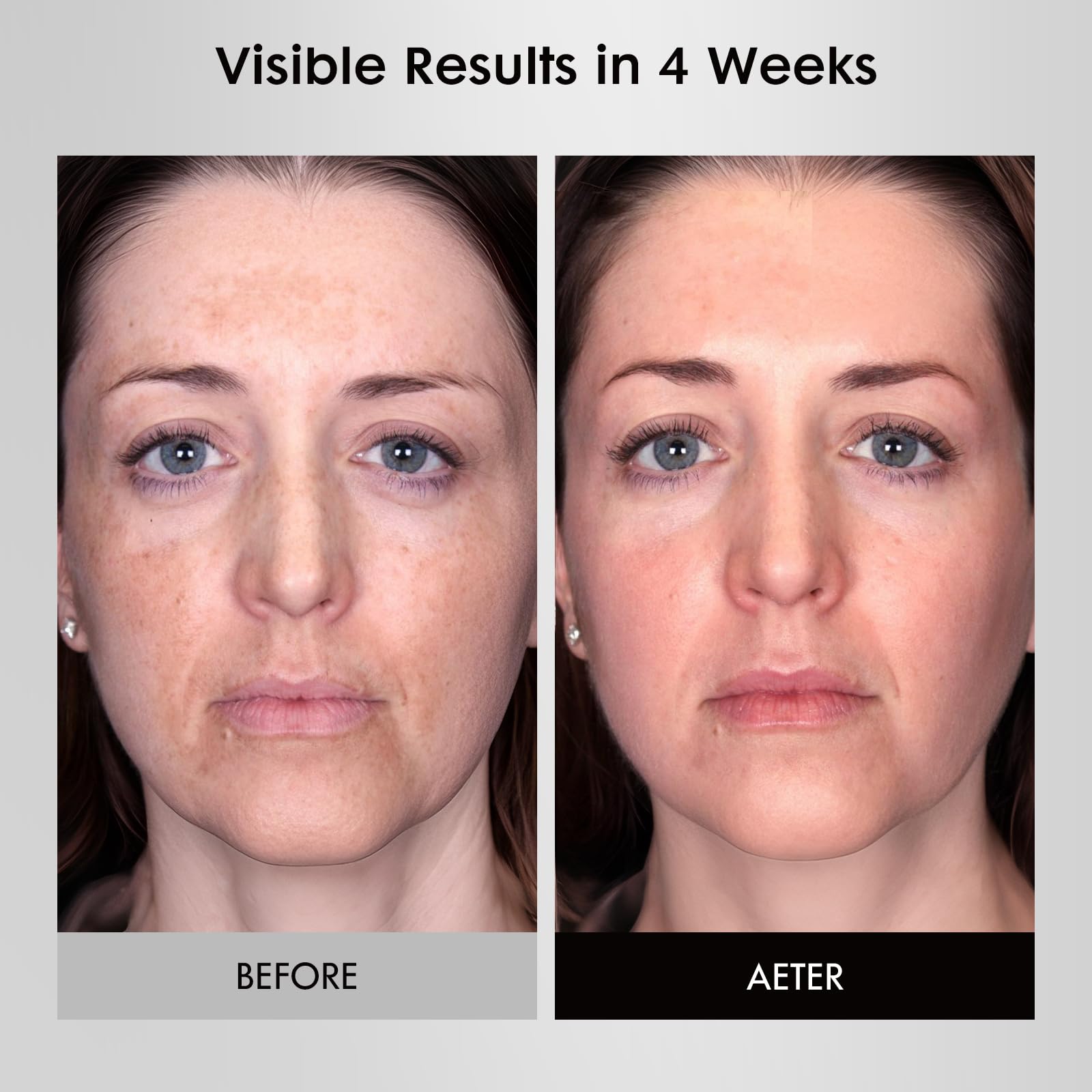 Umitec LED Face Mask silicone body emphasizes skin-friendly, comfortable fit