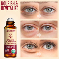 UpNature puffy eyes roller head ready for quick refresh
