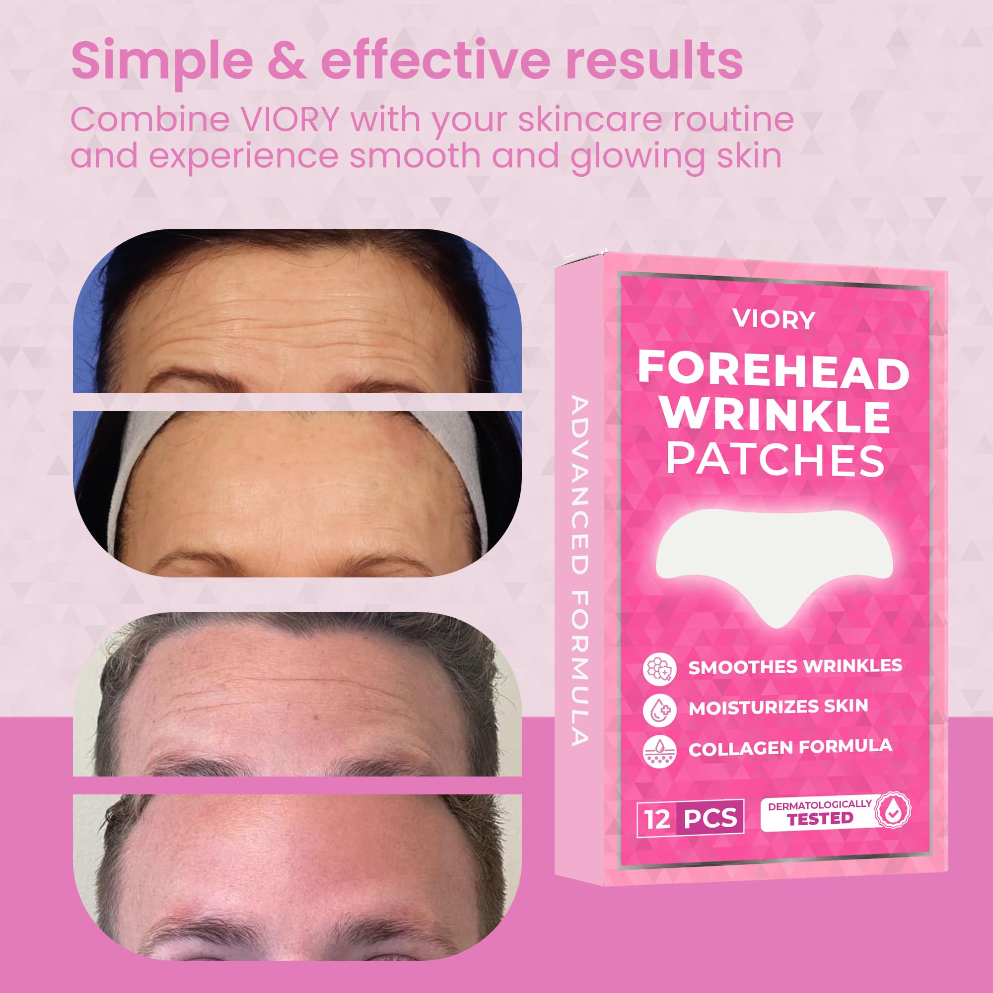 VIORY Forehead Patches ingredients include aloe, collagen, vitamin E, and hyaluronic acid