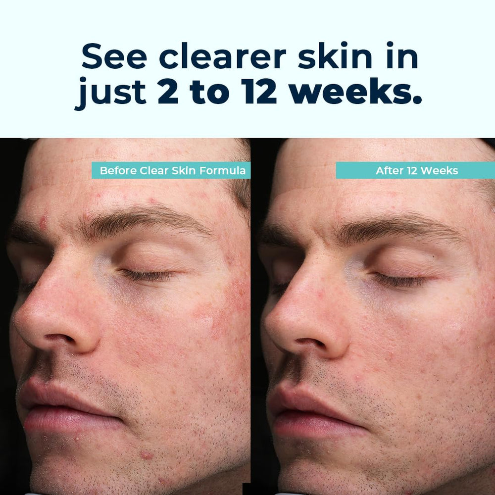 VitaMedica Clear Skin packaging on a desk suggests reliability