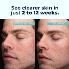 VitaMedica Clear Skin packaging on a desk suggests reliability