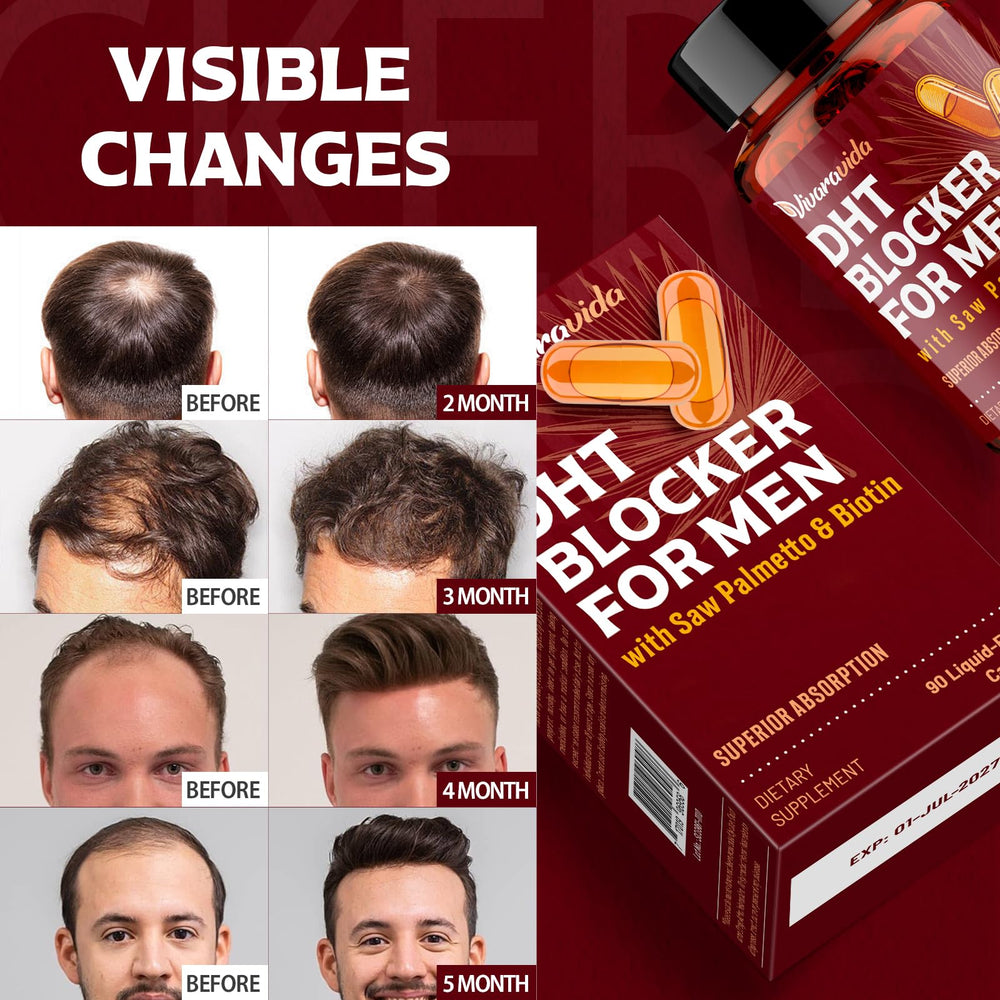 Vivaravida DHT Blocker daily-use scene with capsules