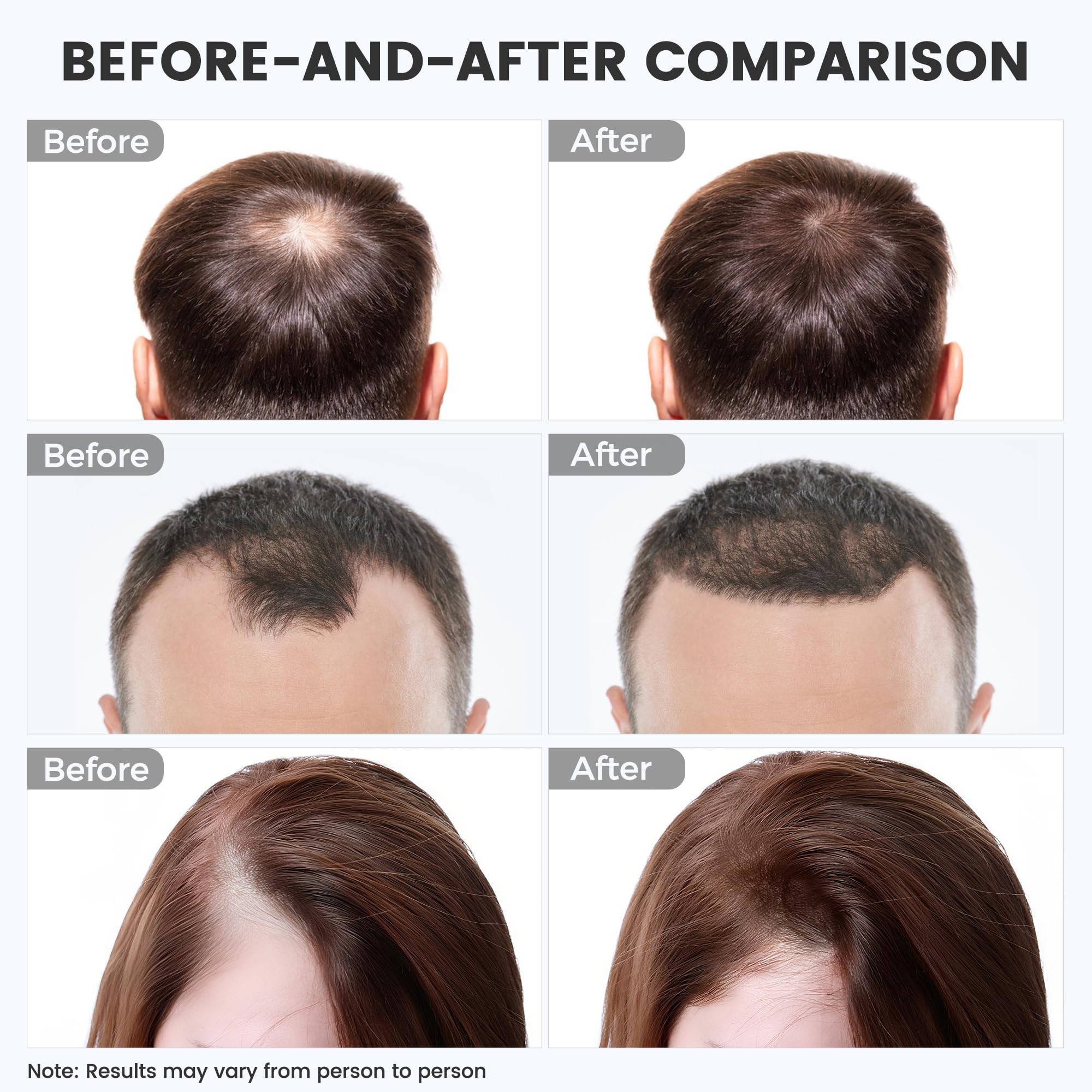 WEETALL red light hair cap showing rechargeable battery for movement