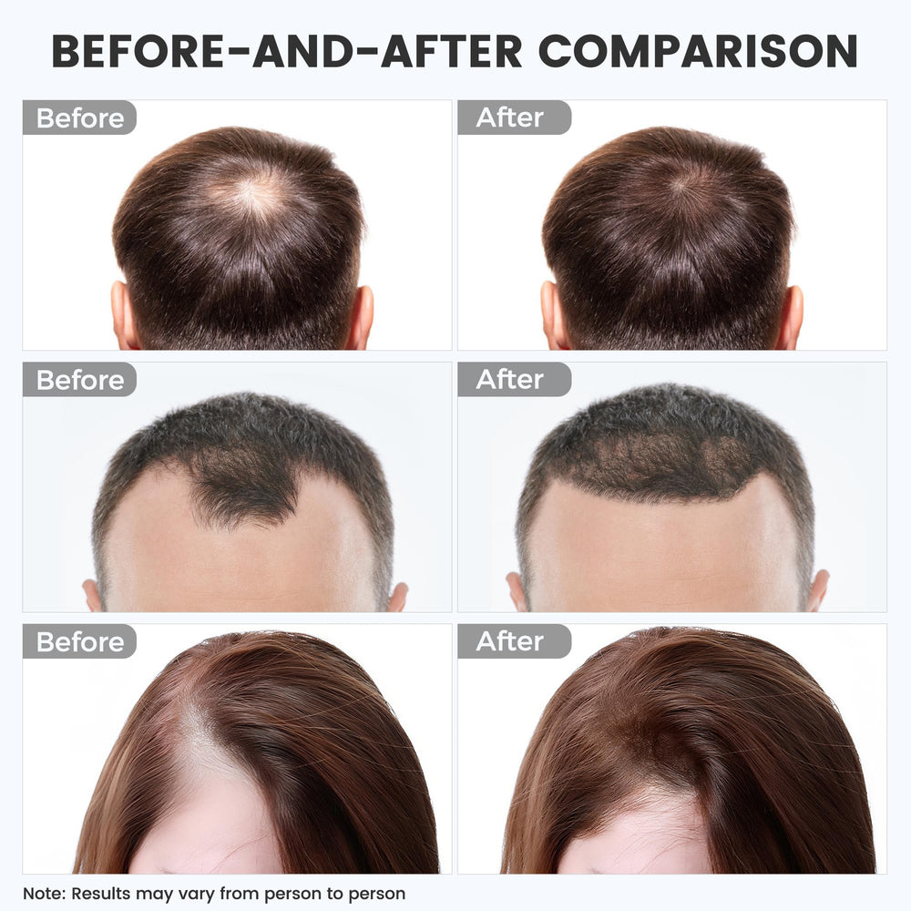 WEETALL red light hair cap showing rechargeable battery for movement