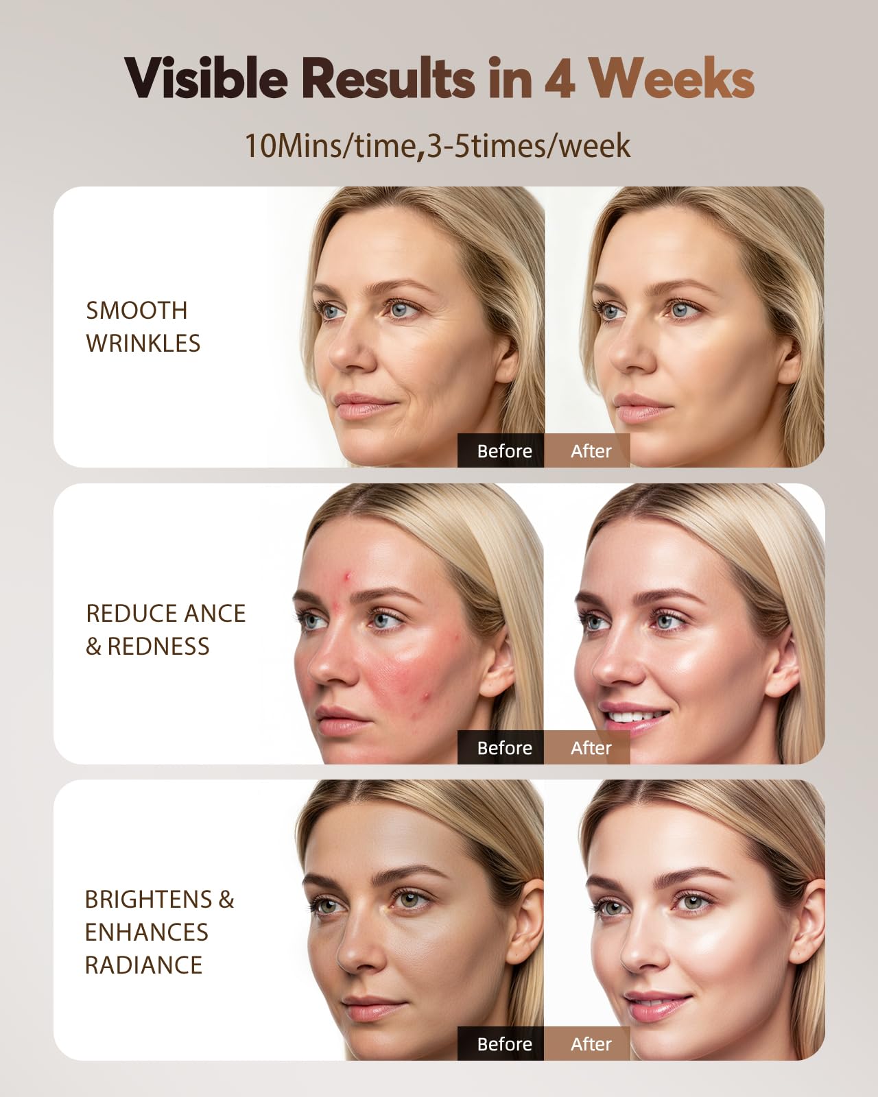 XSSNVV led mask amber light 580nm for brightening routines