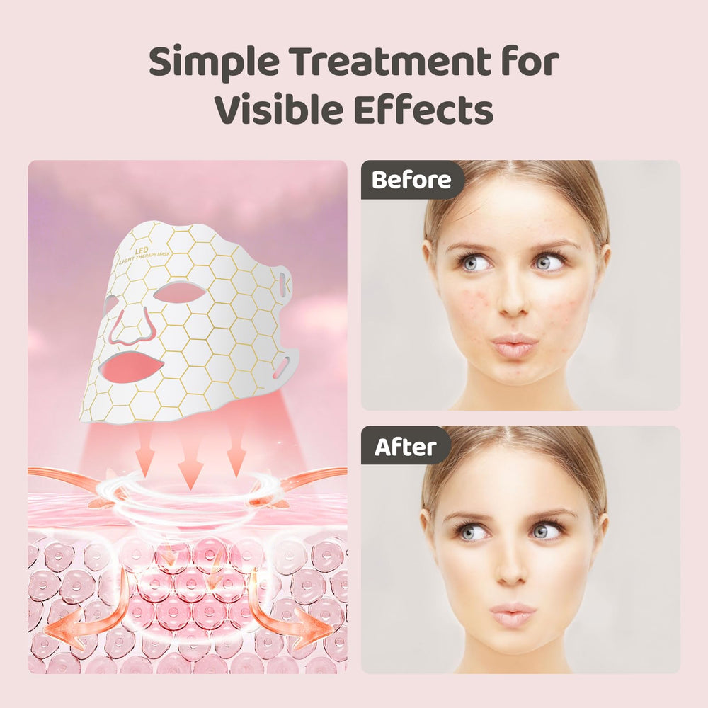 Yahi remote-control timer LED mask for simple daily adjustments