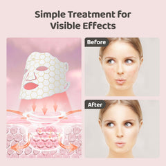 Yahi remote-control timer LED mask for simple daily adjustments