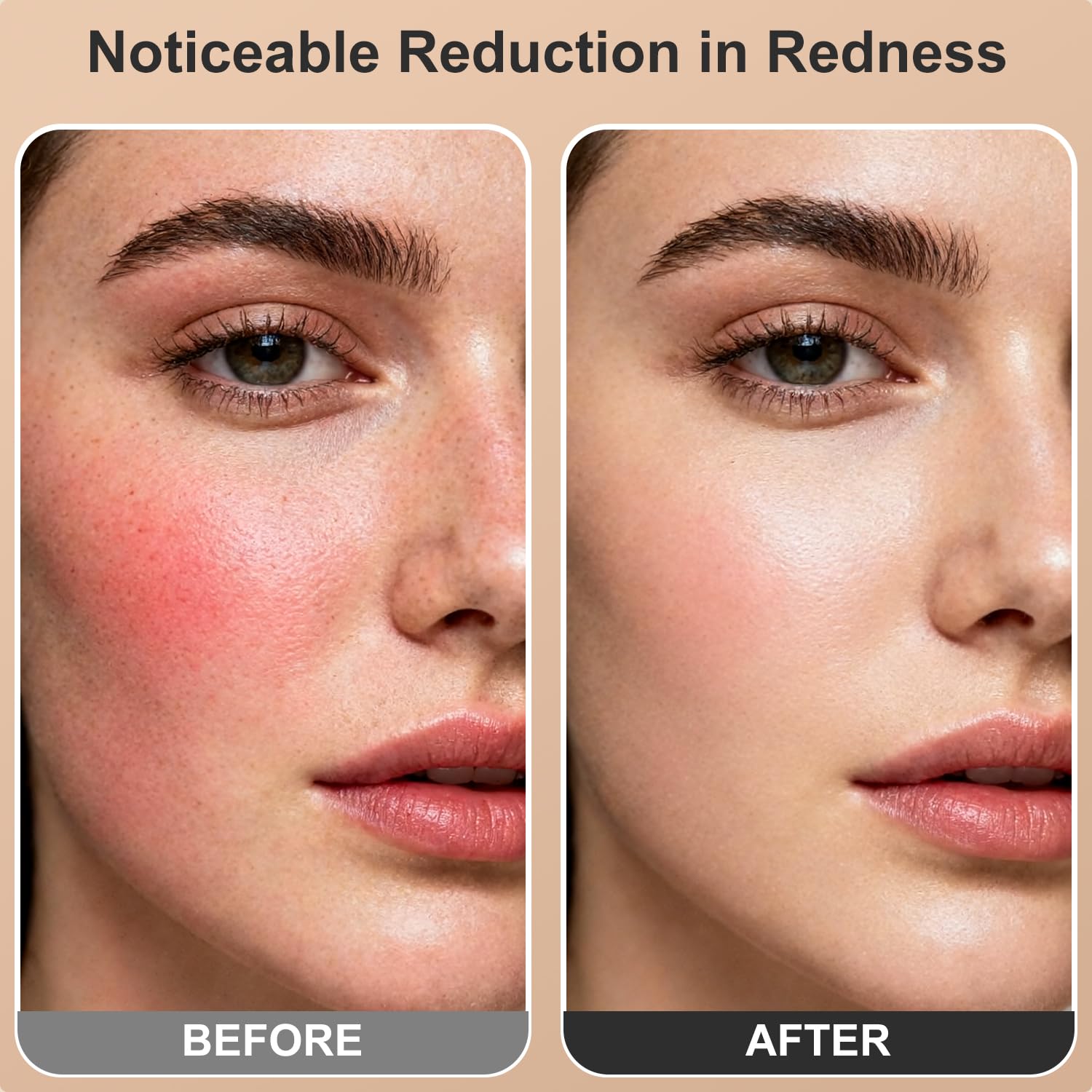 Ziptly red light in facial use promoting soothing sessions.