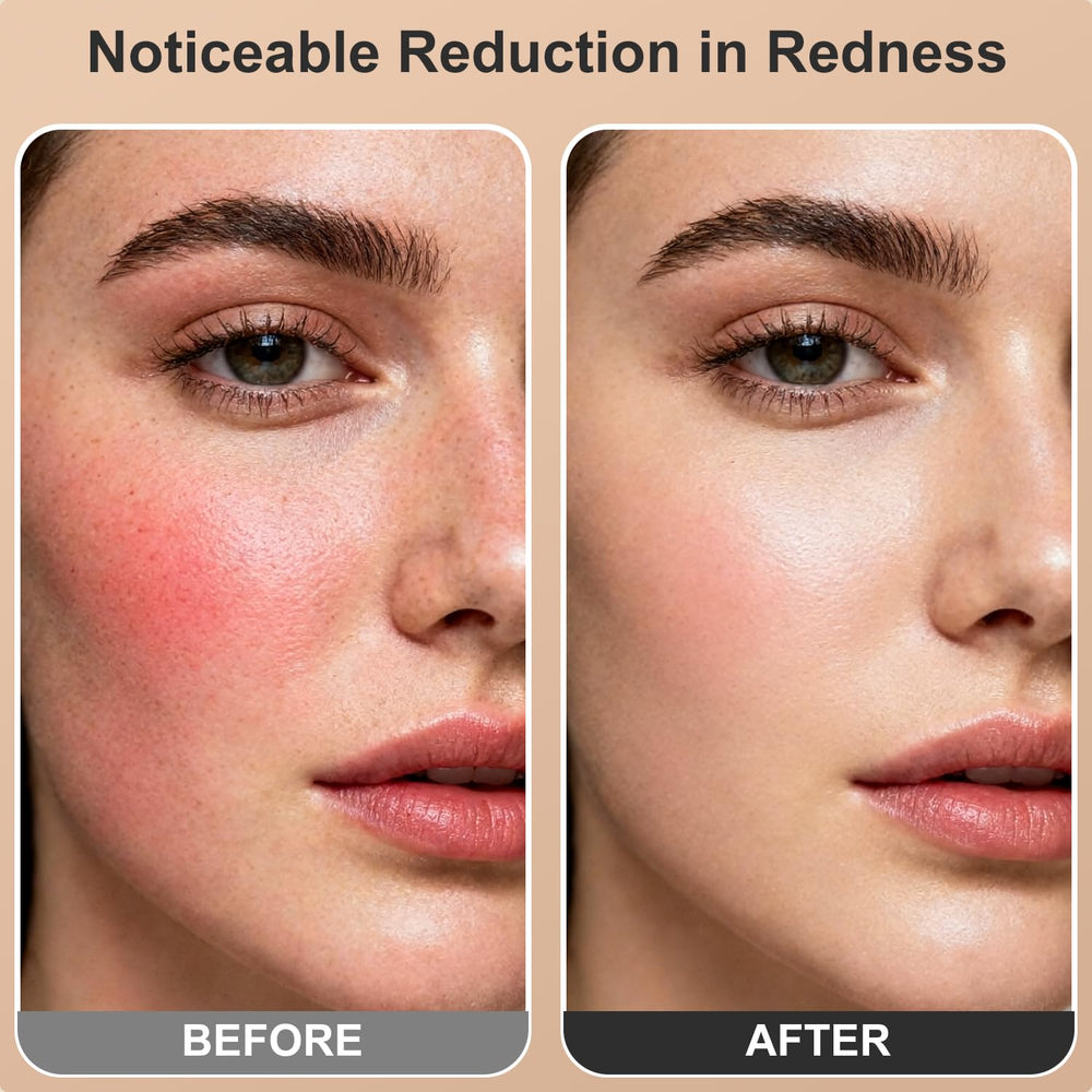 Ziptly red light in facial use promoting soothing sessions.